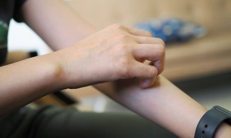 Women are scratching their arms concept of itching from skin diseases