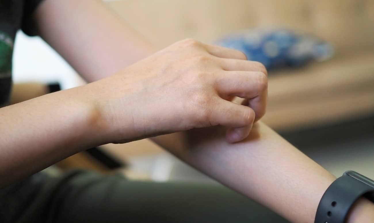 Women are scratching their arms concept of itching from skin diseases